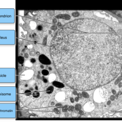 Label the transmission electron micrograph of the mitochondrion