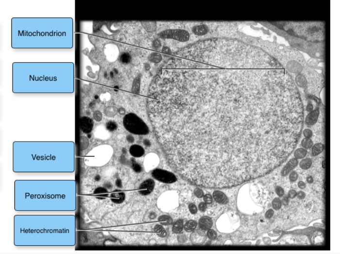 Label the transmission electron micrograph of the mitochondrion